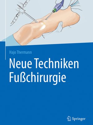 cover image of Neue Techniken Fußchirurgie